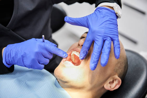 Best Emergency Dentist for Knocked-Out Tooth in Gettysburg, PA